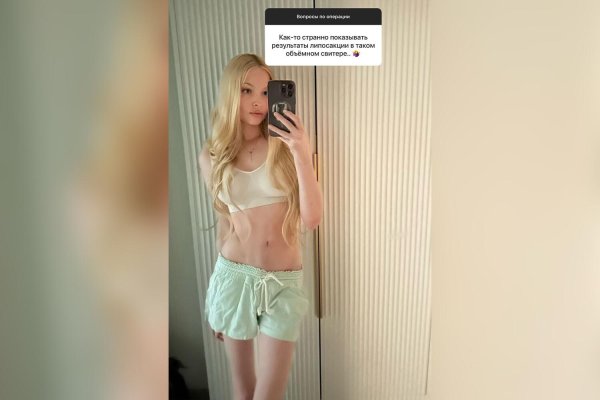 Алена шишкова анорексия, Модель алена шишкова, Алена шишкова анорексия 2023