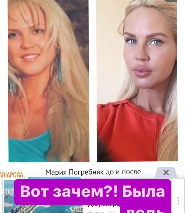 Мария погребняк до пластики, Мария погребняк до и после пластики, Погребняк мария до и после пластика