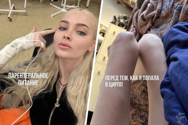 Алена шишкова анорексия, Модель алена шишкова, Шишкова алена