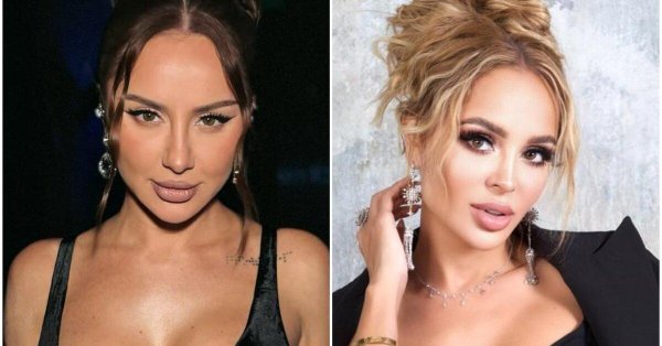Асти анна дзюба до пластики, Анна асти, Анна асти до и после пластики