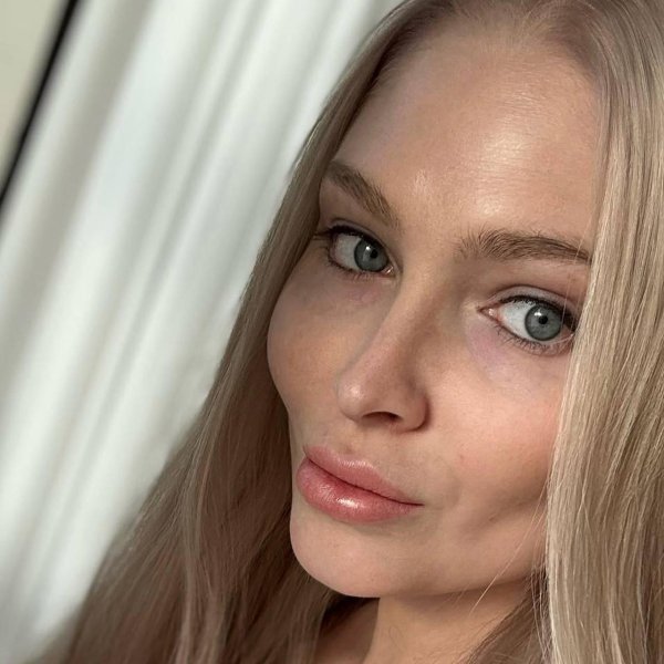 Модель алена шишкова, Алена шишкова до и после пластики, Шишкова алена