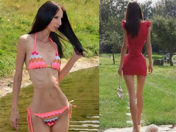 Худая женщина, Самая худая девушка, Очень худая девушка