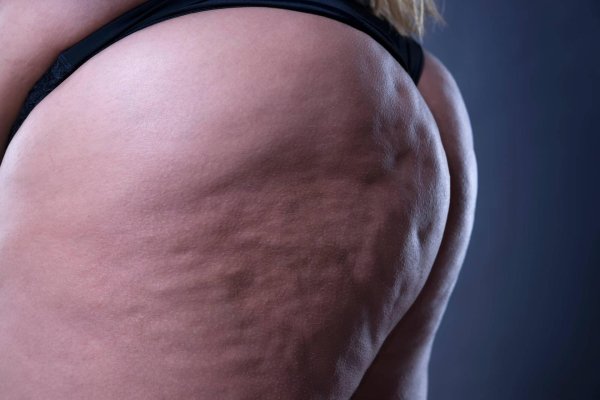 Женщина с аппетитной целлюлитной попой в соблазнительном ракурсе