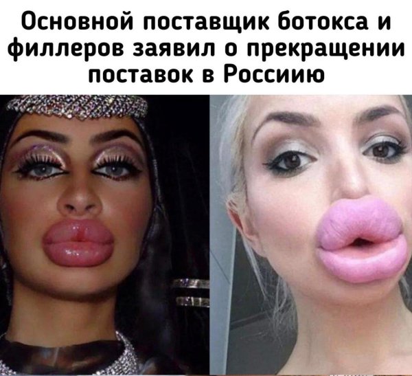 Накаченные губы, Накачала губы, Девушки с накаченными губами