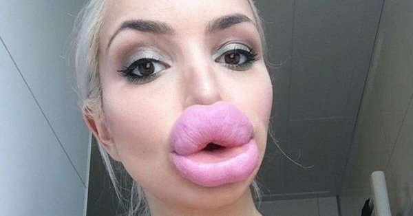 Огромные губы, Накаченные губы, Губы уточка