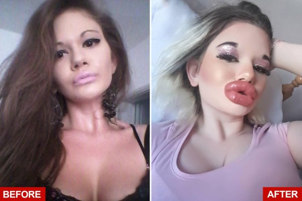 Андреа Иванова с самыми потрясающими губами в мире