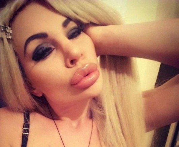 Элина ромасенко, Девушка с огромными губами, Девушка с большими губами