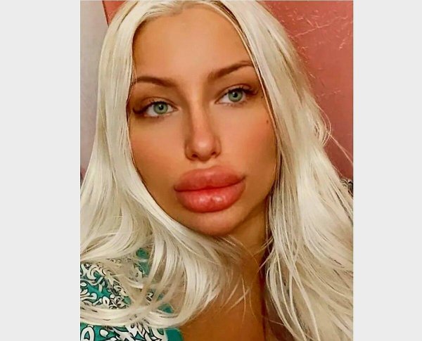 Кристина шейк, Мироян kristinashayk, Накаченные губы