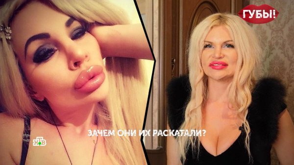 Элина ромасенко, Блондинка с большими губами, Накаченные губы