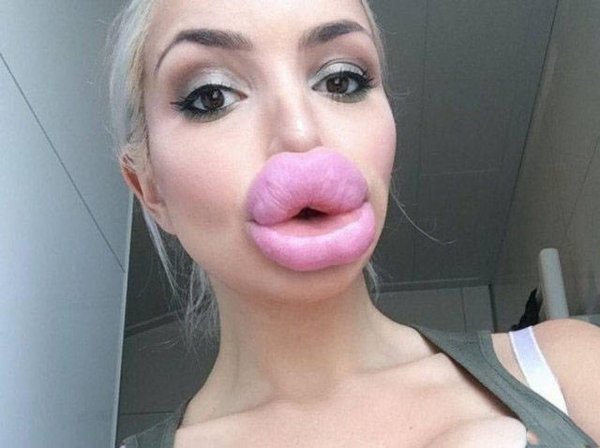 Накаченные губы, Огромные губы, Девушки с накаченными губами