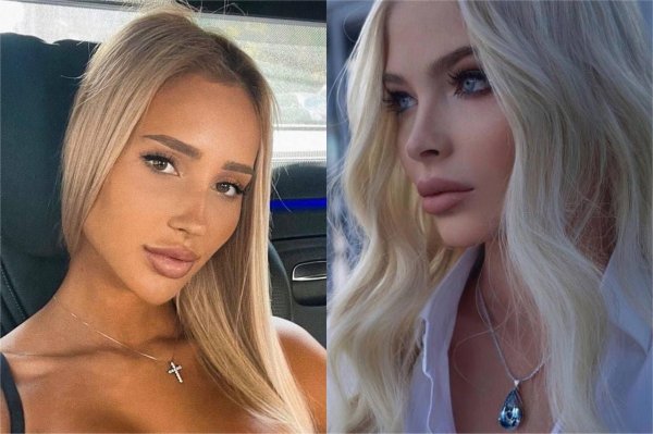Девушка тимати валентина до пластики, Шишкова до пластики, Новая девушка тимати