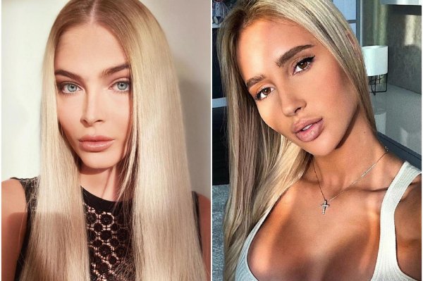 Девушка тимати валентина до пластики, Алена шишкова до и после пластики, Шишкова до и после пластики