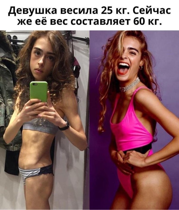 Худые девушки которые поправились, Девушки победившие анорексию, Худая девушка