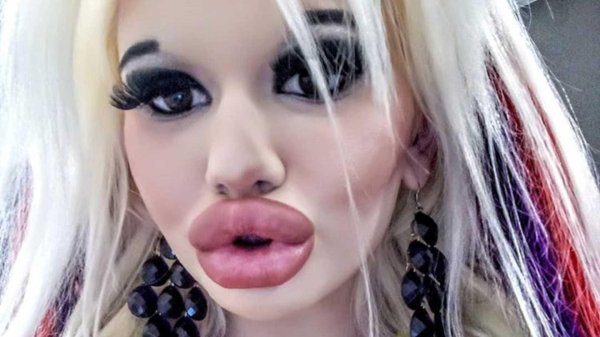 Андреа иванова, Девушка с самыми большими губами, Блондинка с большими губами
