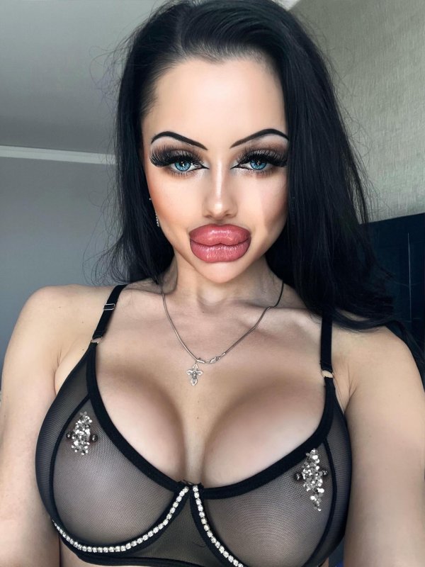 Allison alis, Силиконовые губы, Накаченные губы